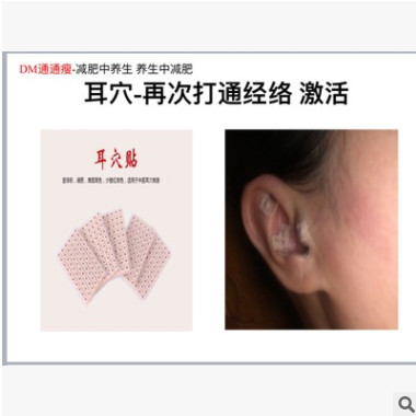 专用耳穴鱼美人耳贴磁珠钢珠贴活血通经络疏通血液循环增加微循环图2