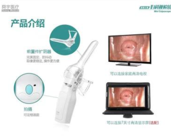 妇科自检镜FA1星天使阴道检查/可视镜头/妇科监测图1