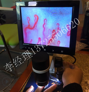 微循环检测仪 超清微循环检测仪 高清微循环检测仪 微循环880图1