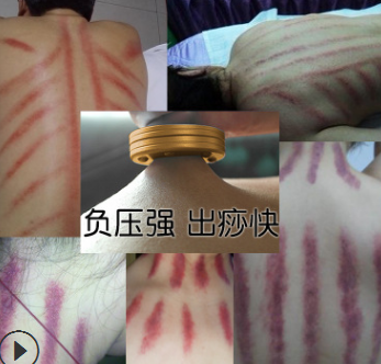 排酸仪平衡理疗刮痧拔罐祛湿排毒批发一件代发多功能负压养生仪图3