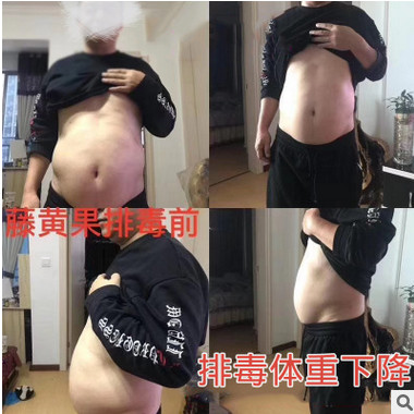 藤黄果 排油美藤果美藤果肠排双排脂迪毒果 oem代加工 成品招代理图2