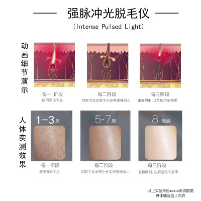 激光脱毛仪器迷你家用脱毛器小型腋下私处脱毛机女士跨境IPL脉冲图3