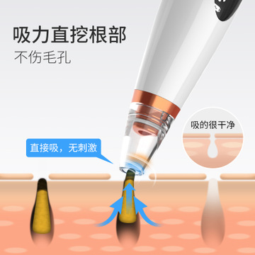 吸去黑头神器电动美容仪家用脸部去毛孔机粉刺清洁仪器图3