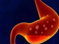 中医是如何认识脾胃概念的。哪些慢性胃炎患者适合中医针灸治疗