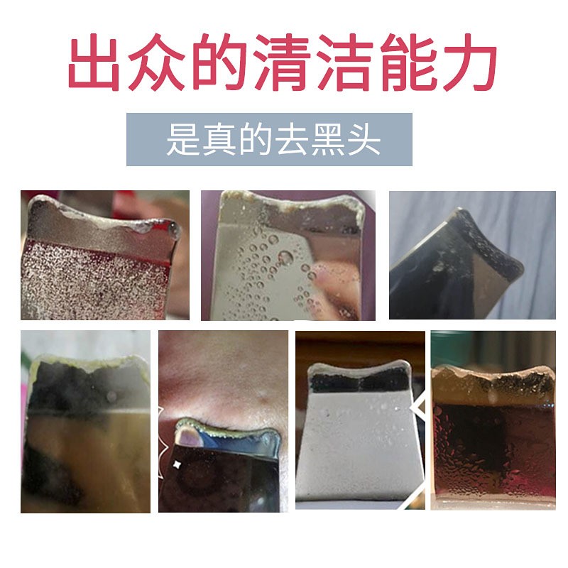 比森新款铲皮机 33K黑头铲离子导入导出面部按摩清洁超声波 铲皮机图3