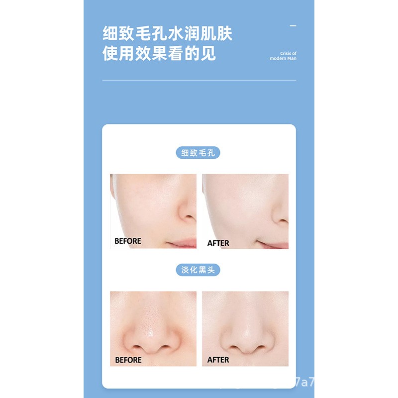 韩国超微六头小气泡补水仪面部深层清洁美容仪皮肤注氧仪综合仪器图3